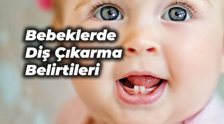 Bebeklerde diş çıkarma belirtileri nelerdir?