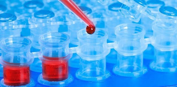 Bu testler kadınlar için hayati önem taşıyor