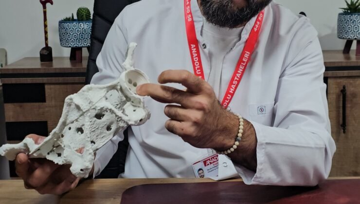 60 yaşındaki kadın 3D yazıcıyla üretilen kalça proteziyle sağlığına kavuştu