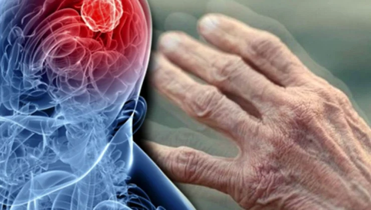 Tarım Ilaçları Parkinson Riskini Artırabilir